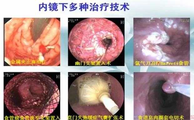 最新胃肠镜医生招聘，专业人才需求迫切与前景展望